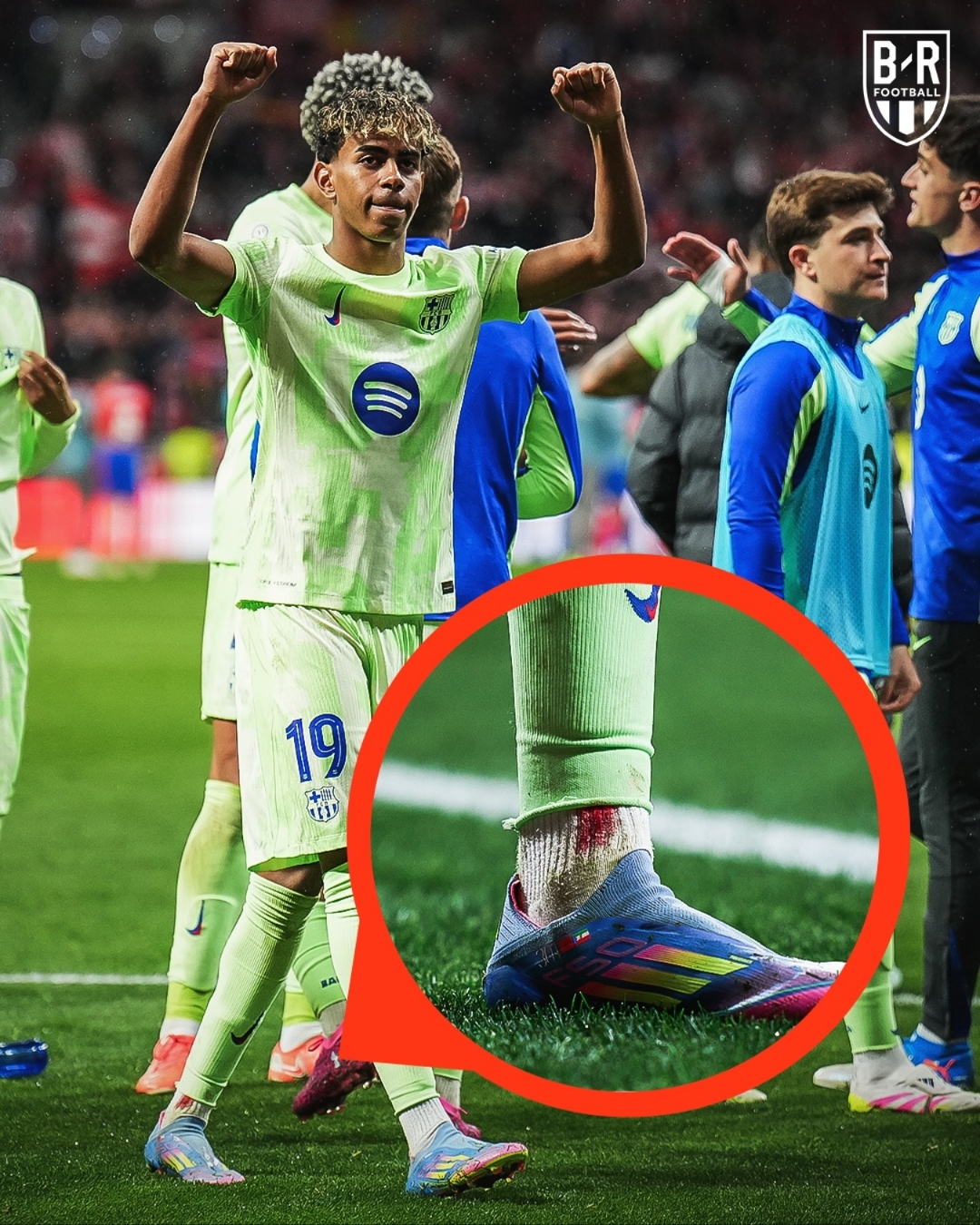 vsports体育-马赛中场多次突破出色表现,让对手手足无措-第2张图片-V体育 vsports体育-马赛中场多次突破出色表现,让对手手足无措-第2张图片-V体育